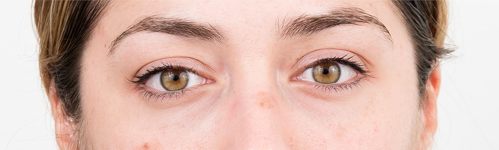 "I want to get rid of the tired look around my eyes!" Well, come and have this revolutionary eyebag treatment!