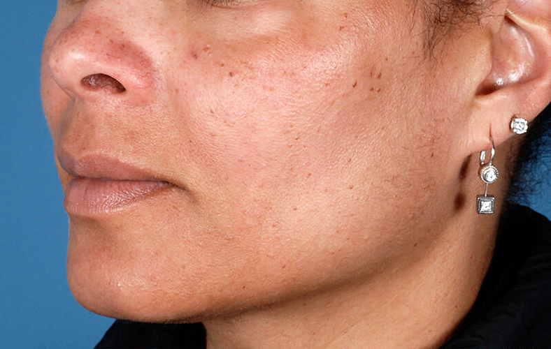 ZO Skin Health, sl. 2 - prije