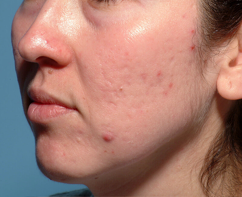 ZO Skin Health, sl. 3 - prije